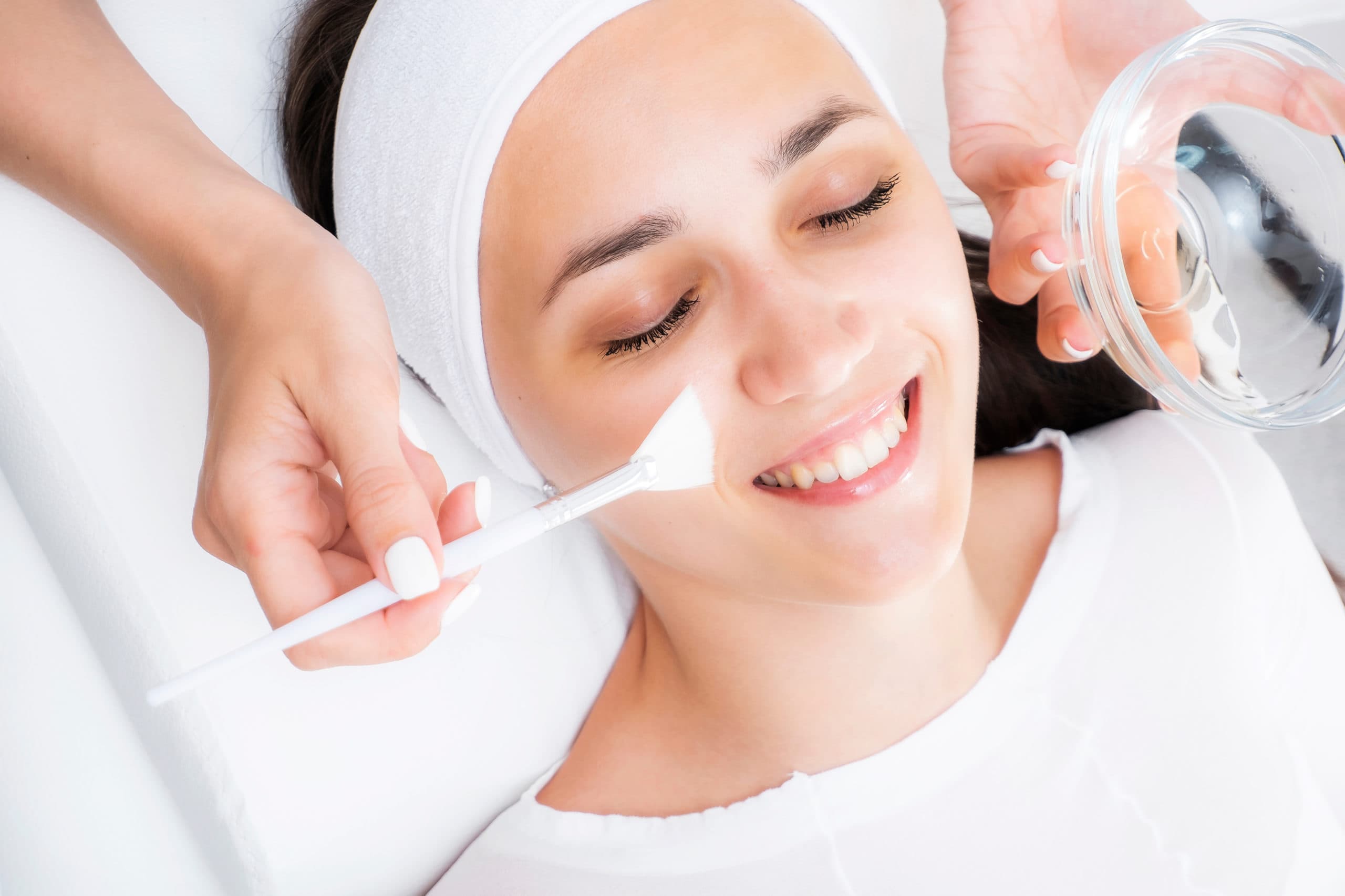 Chemical Peel